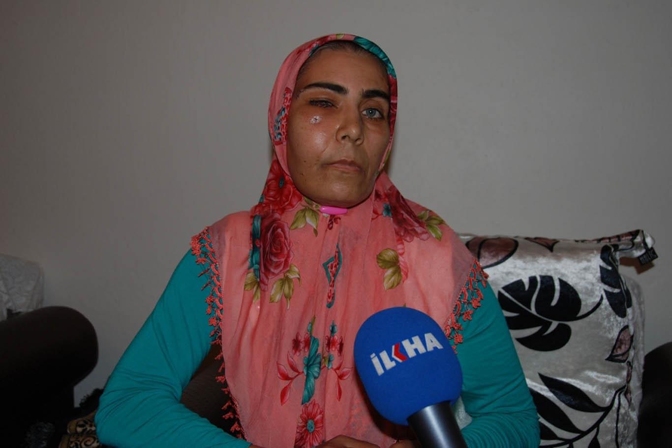 PKK’nin yaraladığı kadın gözünü kaybetti PKK’nin yaraladığı kadın gözünü kaybetti